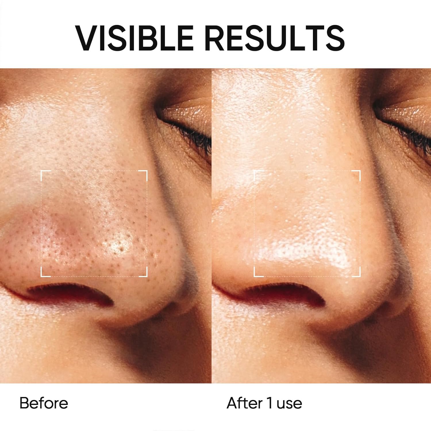 Pore detail